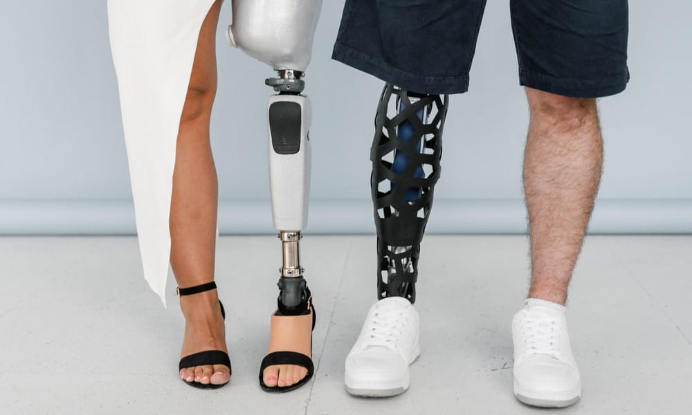  A photo of two individuals' legs, each wearing a prosthetic leg. 